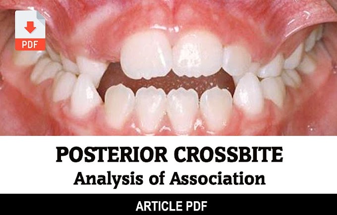 PDF: Analysis of Association between Posterior Crossbite, Median Line Deviation and Facial Asymmetry