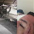 LIXO MOTIVOU AGRESSÕES MUTUAS NA MERCEARIA DO ZINHO EM OURINHOS