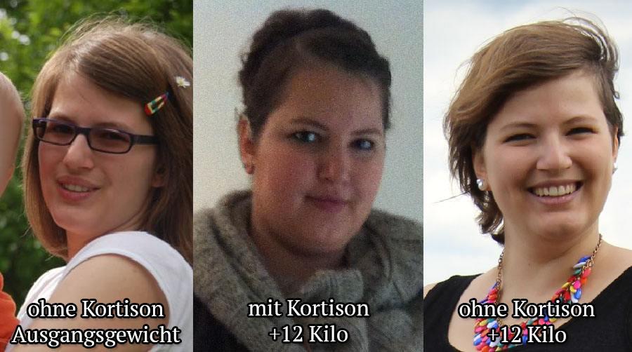 Schönheitsideale, Babyspeck und Kortison