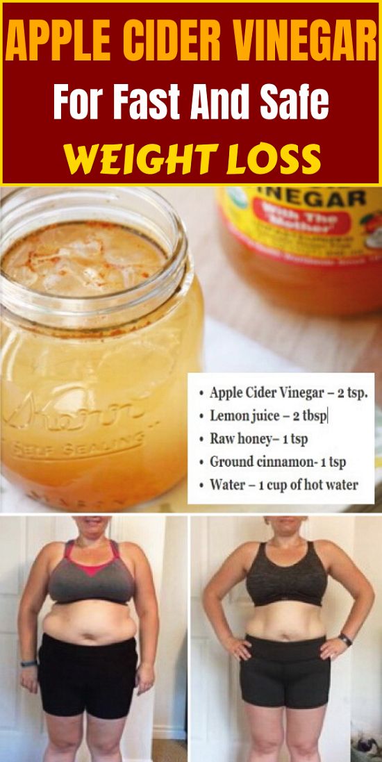 Apple Cider Vinegar For Fast And Safe Weight loss Aman Terus