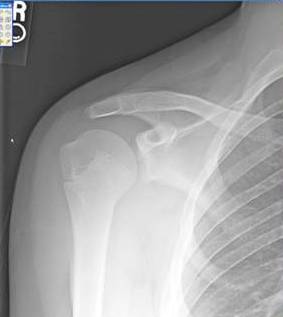 Musculoskeletal Plain Film Series - Sumer's Radiology Blog