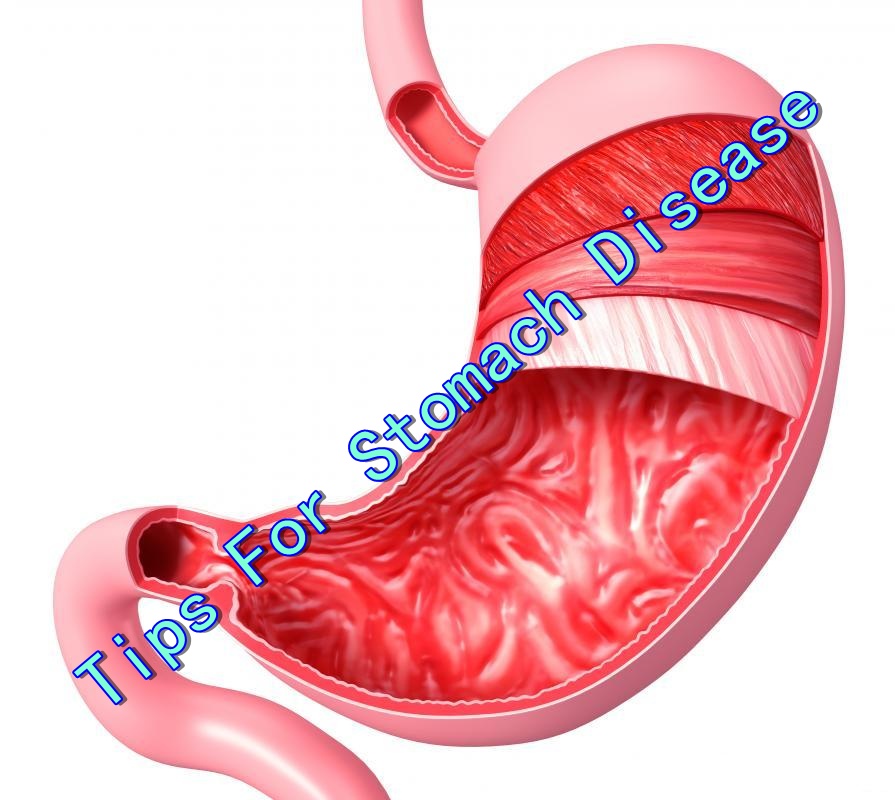 Diseases Stomach Diseases