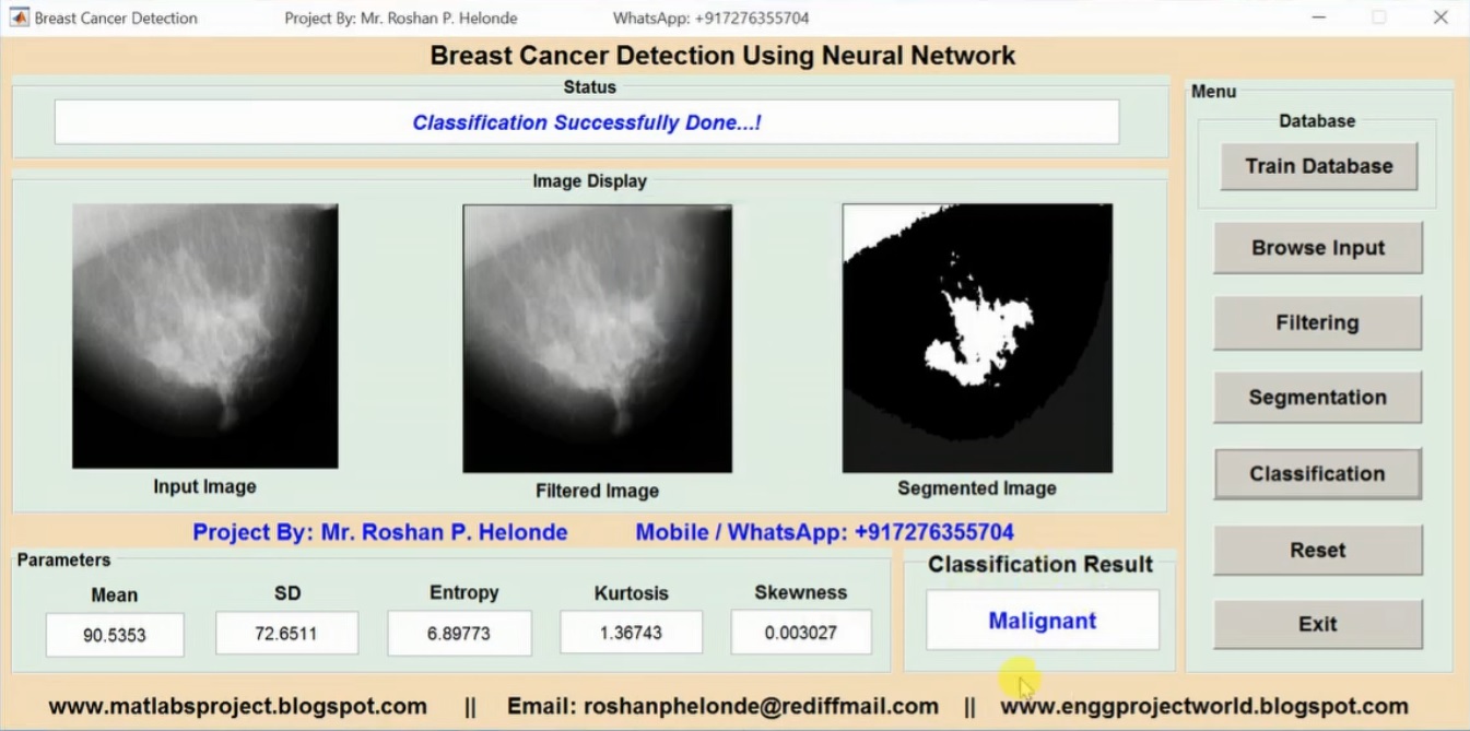 Breast Cancer Detection Using Neural Network Matlab Project With Source