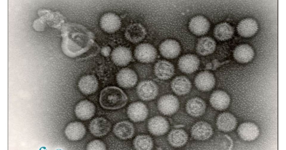 Egg Drop Syndrome 1976 (EDS’ 76) Saude Animal