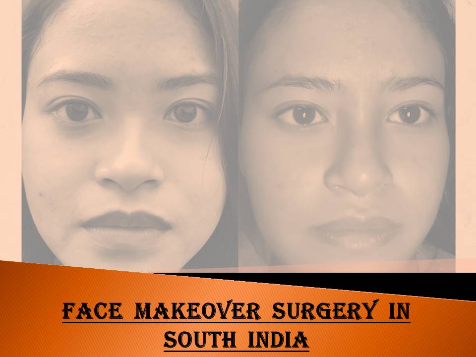 Anesthesia for Scar Removal Face Surgery Intubation Dr. Sunil