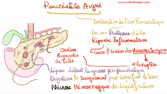 Clinical practice guideline management of acute pancreatitis