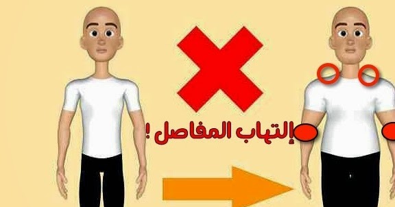 ثقف عقلك أهم الطرق التي تساعدك في علاج إلتهاب المفاصل