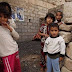 يونيسيف: 2.2 مليون طفل يعانون من سوء تغذية حاد في اليمن