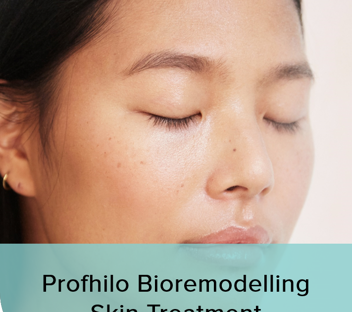 acne scar treatment singapore