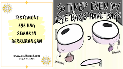 Testimoni Youth Eye Cream: Eye Bag Semakin Berkurangan