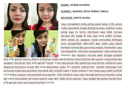 Cara Mengobati Kanker Mata Secara Alami, 100% Terbukti Ampuh Dan Aman Cara Mengobati Kanker Mata Secara Alami