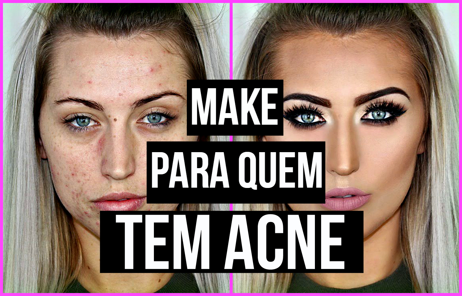 Make para quem tem acne Carolina Sales