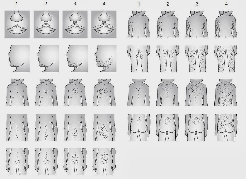 Шкала таннера для мальчиков с рисунками