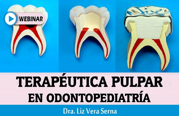 WEBINAR: Terapéutica pulpar en Odontopediatría - Dra. Liz Vera Serna