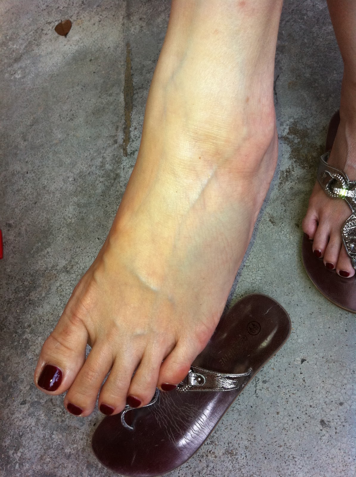 Veins In The Foot