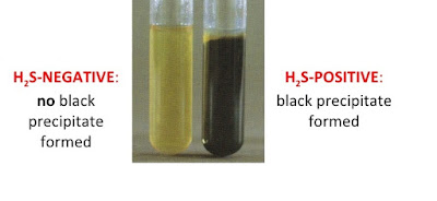SENTHIL PRABHU SIVASAMY: Hydrogen Sulphide (H2S) Production Test