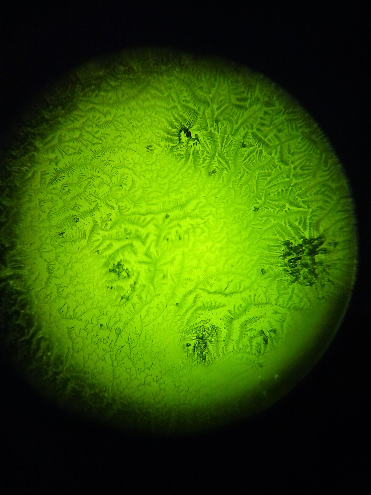 What Is Fertile Saliva Ferning Pattern What Is Fertile Saliva Ferning Pattern