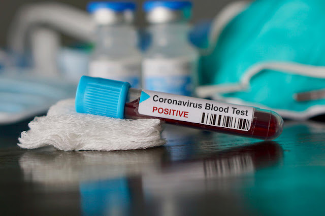 المهدية : تسجيل 107 إصابة جديدة و 5 وفيات بفيروس كورونا
