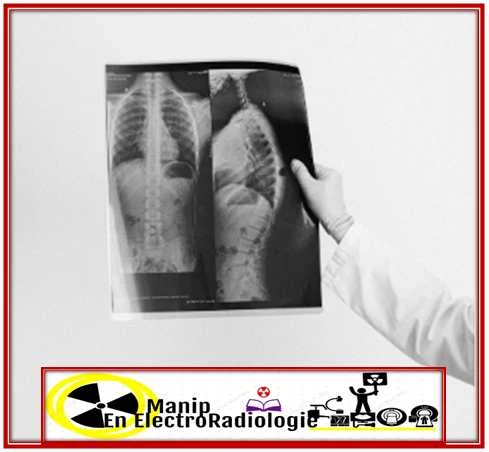 L’exploration radiologique des poumons