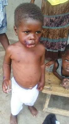 1 Photos: See what a heartless father did to his 3-year-old child for defecating in the bedroom