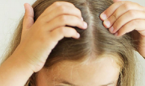 Treatment of hair loss in children with herbs