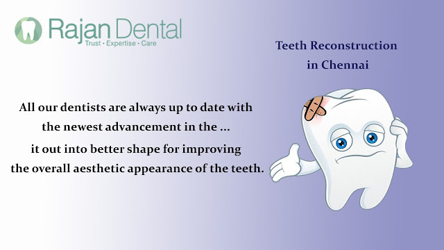  Teeth reconstruction