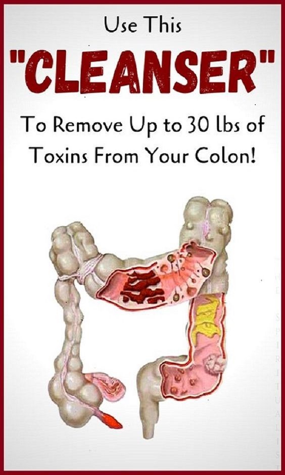 The BEST Colon Cleanser How to Remove 20 lbs of Toxic Waste from Your Colon?!