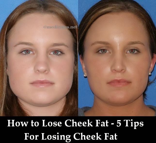 How to Lose Cheek Fat 5 Tips For Losing Cheek Fat