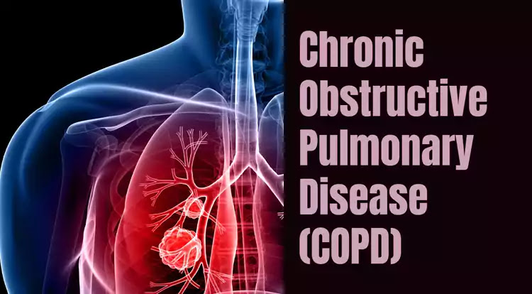 Chronic Obstructive Pulmonary Disease (COPD) : BizGlob