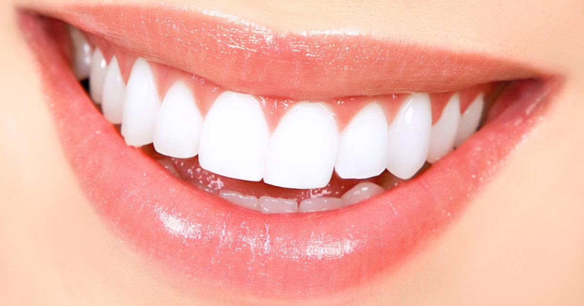 Ricostruire un dente spezzato: cause, rimedi e costi