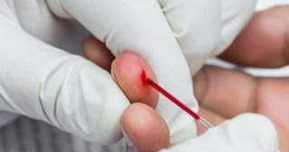 Алгоритм взятия крови из пальца на общий анализ thumbnail