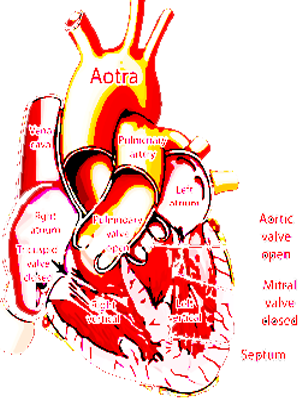 Congenital heart disease