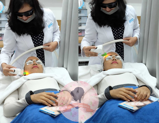 Proses-photo-shower-PPP-Laser-Clinic