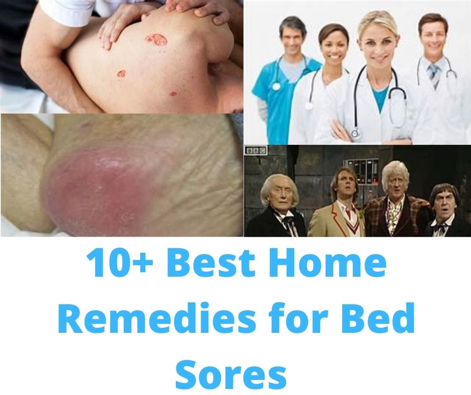 10+ Best Home Remedies for Bed Sores