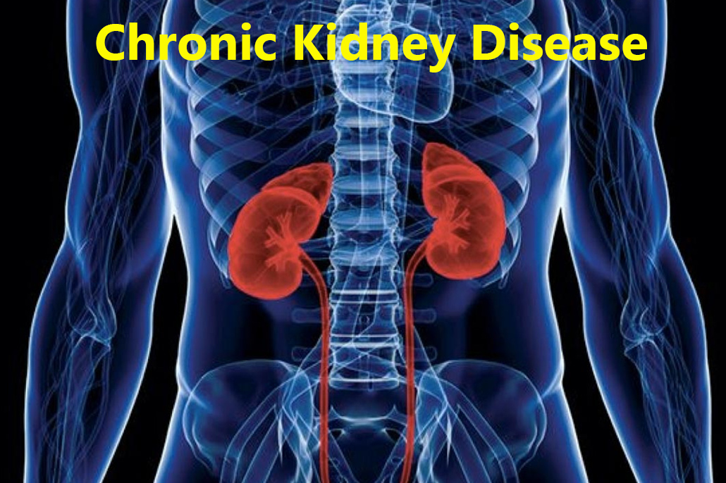 Medical Renal Disease Cochinblogs Ultrasound Imaging In Chronic Renal