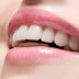 Niềng răng khấp khểnh mất thời gian bao lâu?