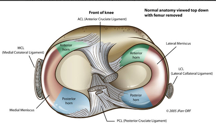 leziune corn posterior menisc intern ligamentele și articulațiile rănesc decât pentru a trata