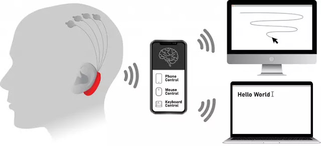 تقنية نيورالينك Neuralink : هل يمكن ان نتحكم في الكمبيوتر من خلال أدمغتنا تقنية نيورالينك Neuralink : هل يمكن ان نتحكم في الكمبيوتر من خلال أدمغتنا