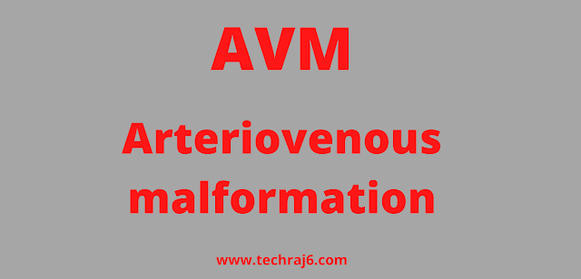 AVM full form, What is the full form of AVM 