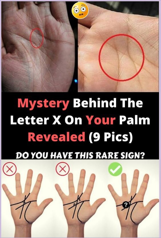 The Mystery Behind the Letter X On Your Palms Revealed! Healthy Lifestyle