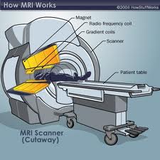 mri scan images of brain tumor Photos and Image.