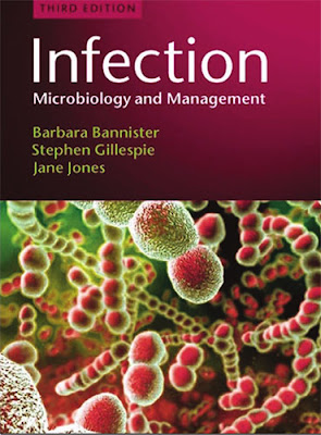 Infection Microbiology and Management