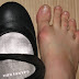 Common Foot Problems In The Summer