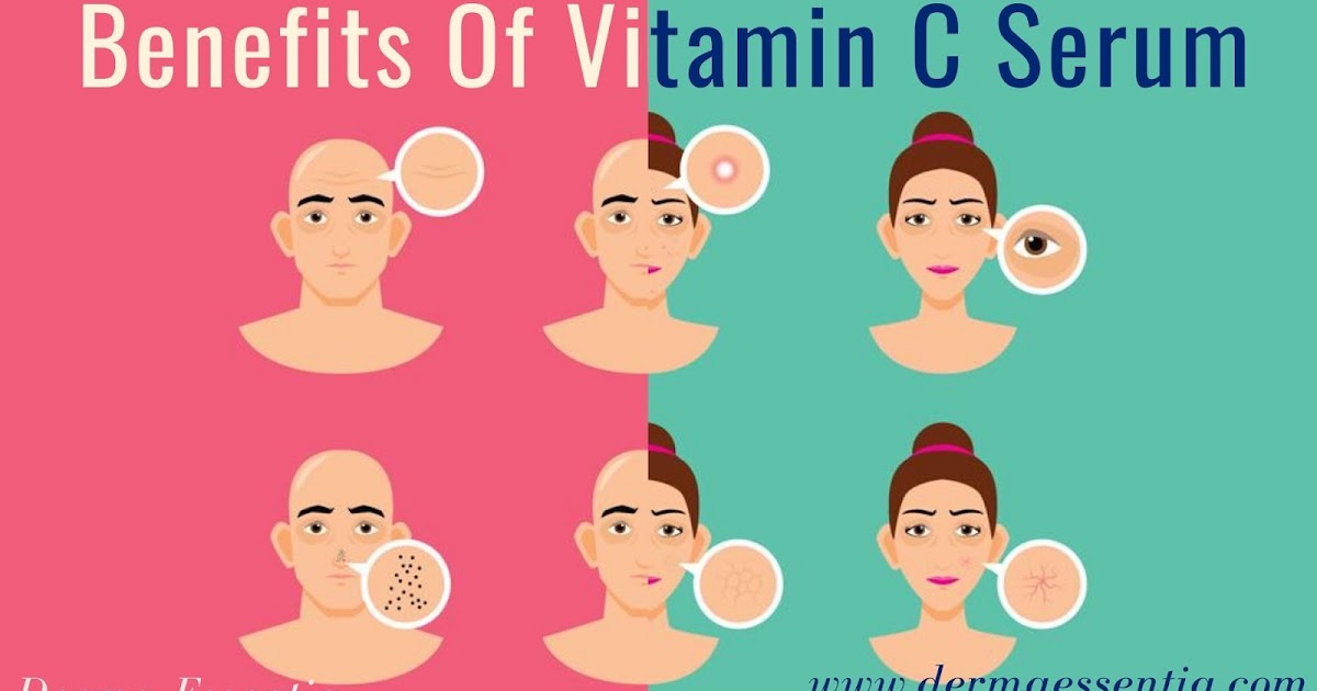 What Does Vitamin C Serum Do for Skin?