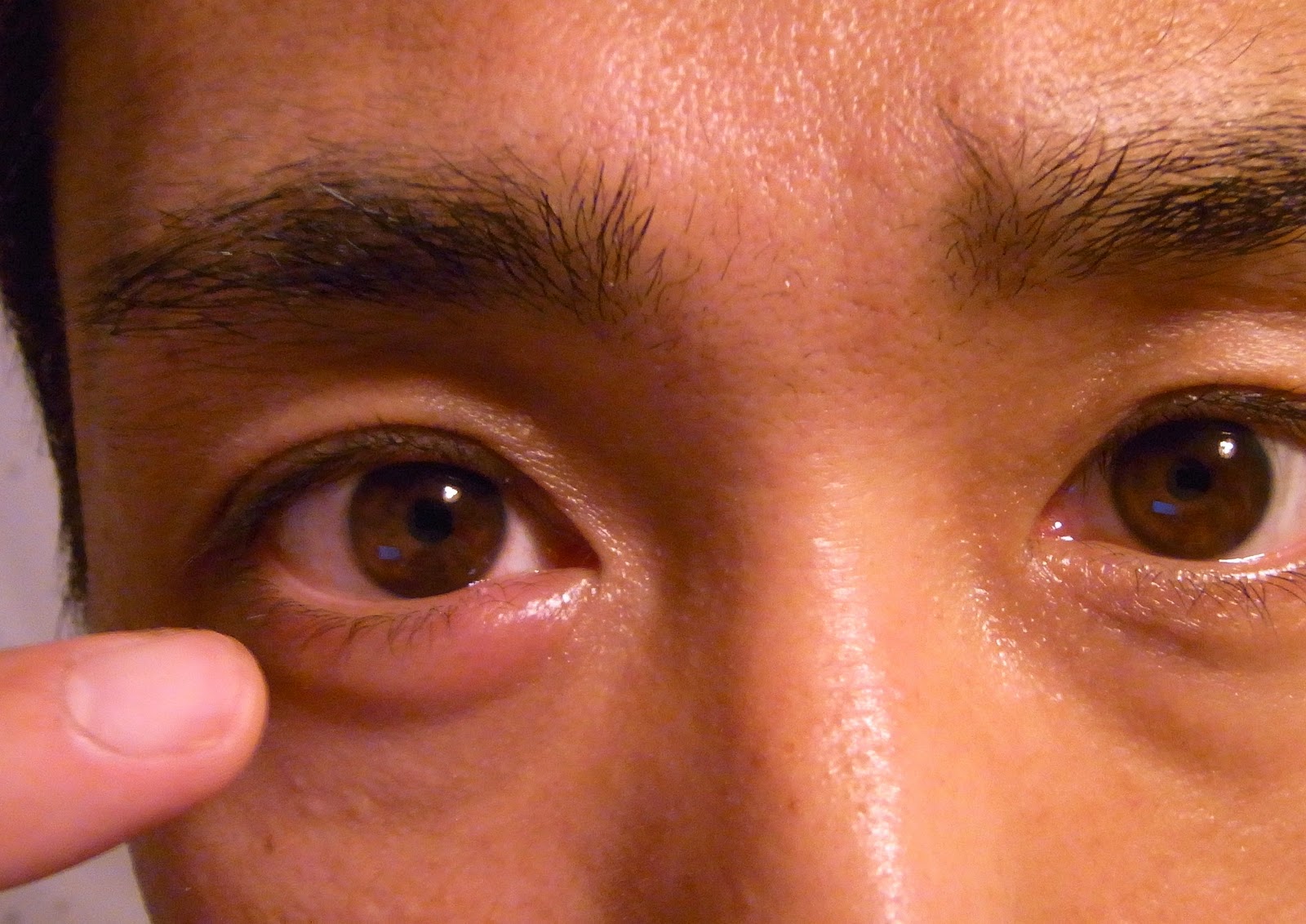 Заболеваниями заболеваний глаз появиться
