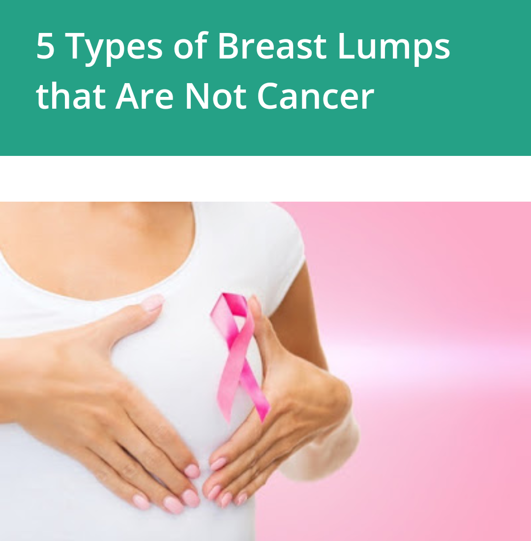 5 types of breast lumps are not cancer