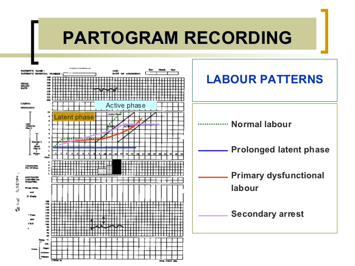Med4yu: Primary Dysfunctional Labor