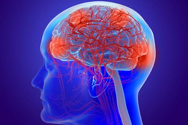 Functional Neurology: What is a Leaky Brain? | El Paso, TX Chiropractor