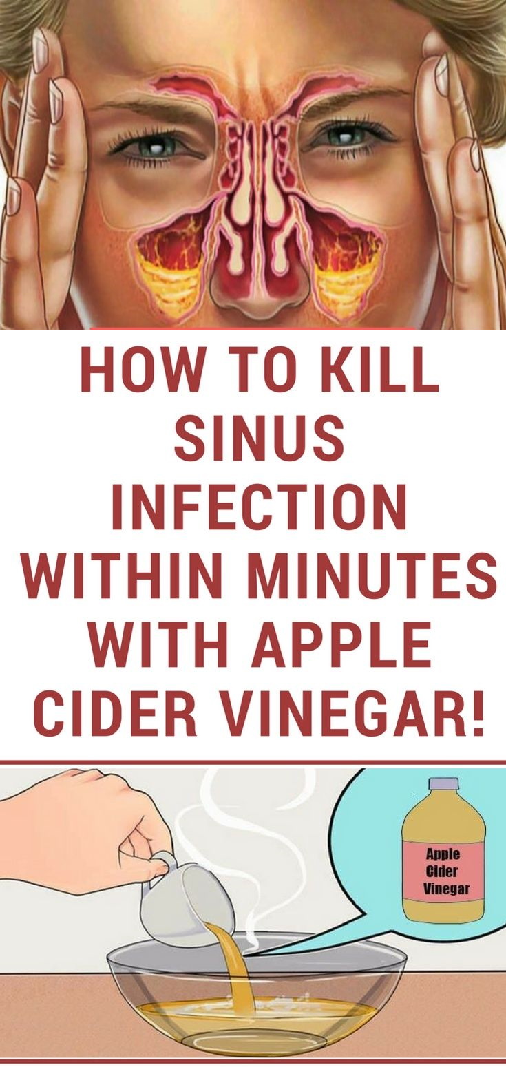 How To Kill Sinus Infection Within Minutes With Apple Cider Vinegar