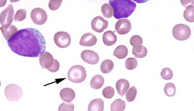ماهي كريات الدم الهدفية target cells